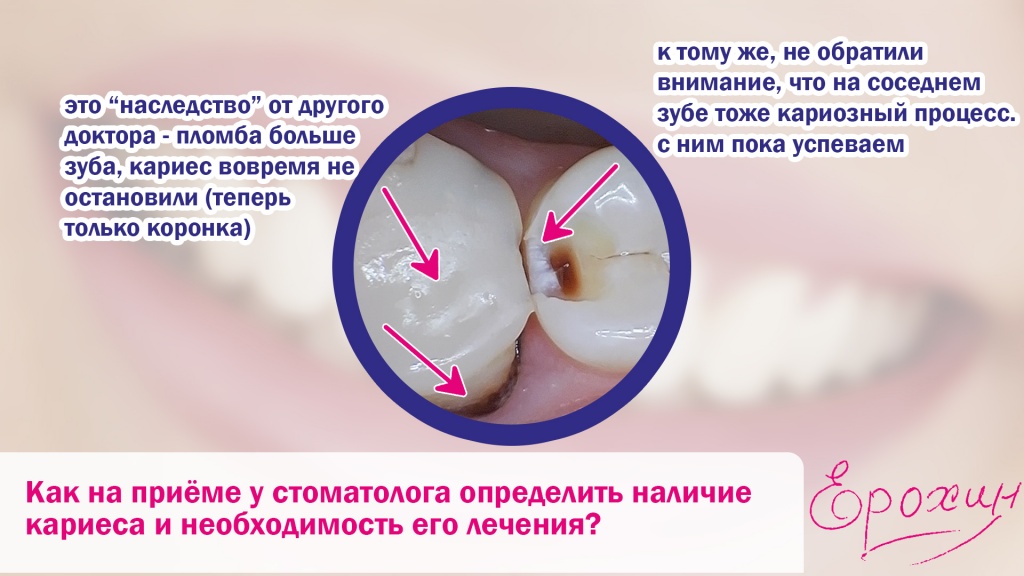 Главное - это успеть поставить диагноз до осложнений